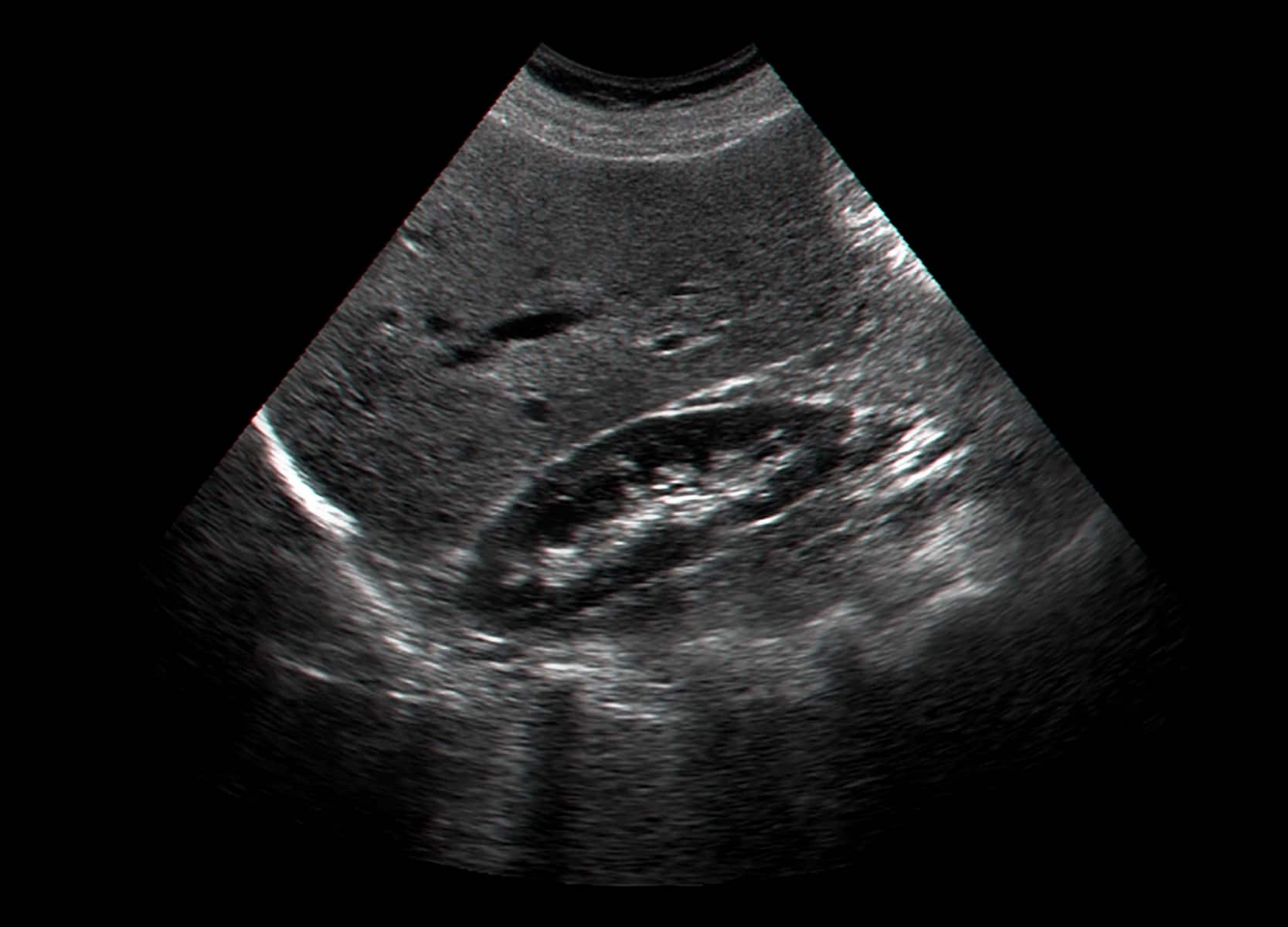 Ultrasound examination of human  internal organs