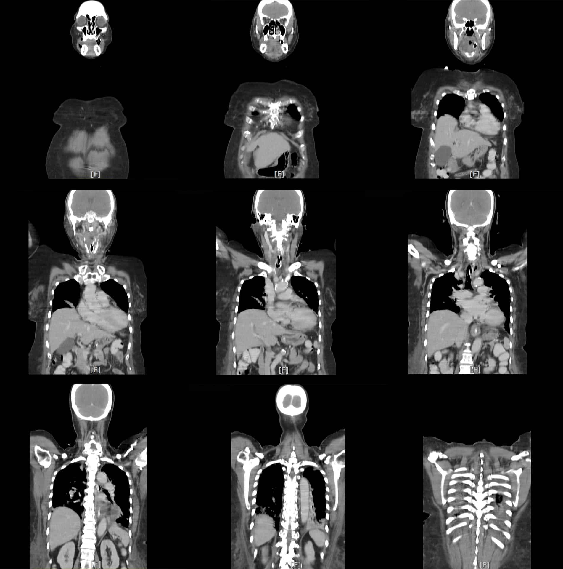 x-ray image mri scan